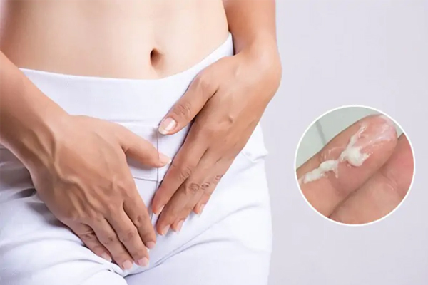 Huyết trắng (khí hư) bất thường – Cách nhận biết và chữa trị hiệu quả
