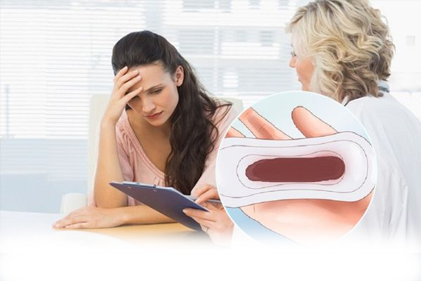 Kinh nguyệt màu nâu là bị gì và phải làm sao để hết?