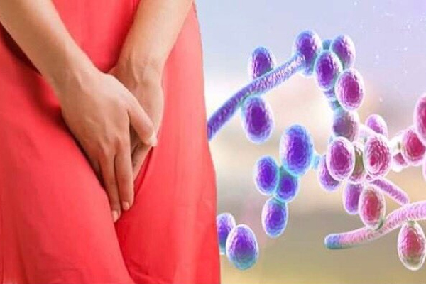 Nấm âm đạo – Nguyên nhân, dấu hiệu và cách điều trị