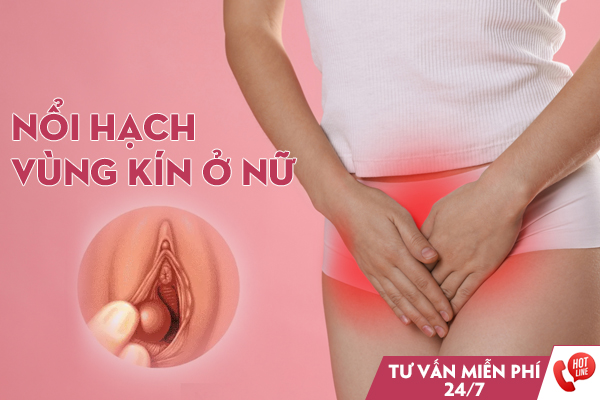 Nổi hạch vùng kín nữ là bị gì? Có sao không?