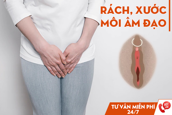 Vì sao nữ giới bị rách, xước môi âm đạo? Biện pháp xử lý an toàn