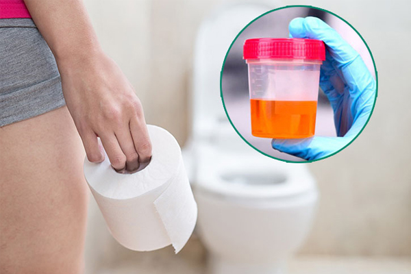 Tiểu ra máu ở nữ – Dấu hiệu cảnh báo nhiều bệnh lý không nên chủ quan
