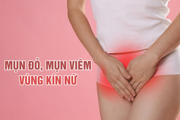 Nguyên nhân gây mụn đỏ, mụn viêm vùng kín nữ