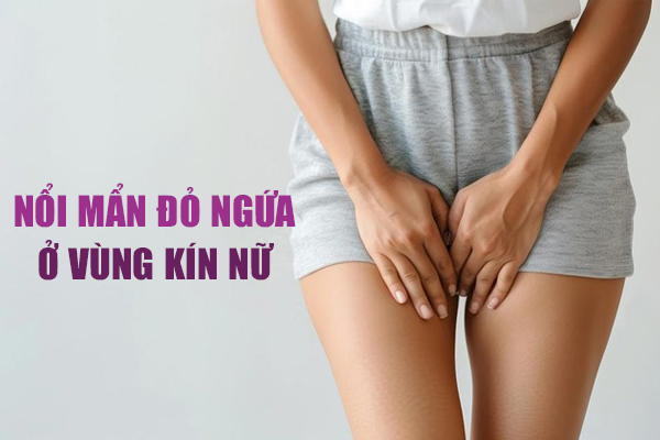 Nổi mẩn đỏ ngứa ở vùng kín nữ là bệnh gì? Cách xử lý hiệu quả, an toàn