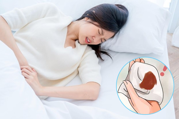 Sau khi quan hệ ra máu nâu – Dấu hiệu cảnh báo sức khỏe sinh sản