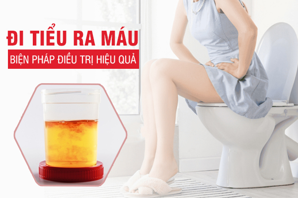 Địa chỉ điều trị tiểu ra máu uy tín, hiệu quả tại Đắk Lắk