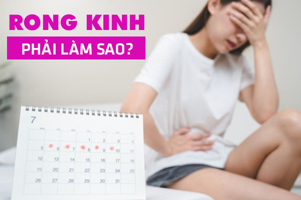 Rong kinh phải làm sao? Bác sĩ chuyên khoa tư vấn chi tiết