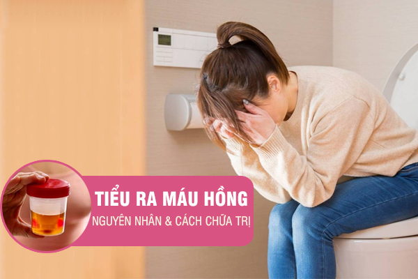 Tiểu ra máu hồng – Nguyên nhân và cách chữa trị hiệu quả